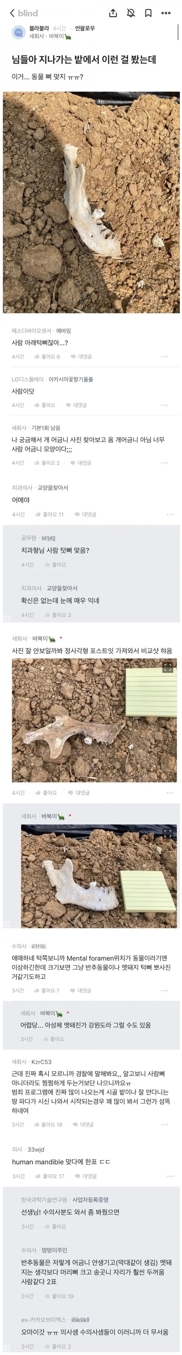 진짜 사람 턱뼈인듯